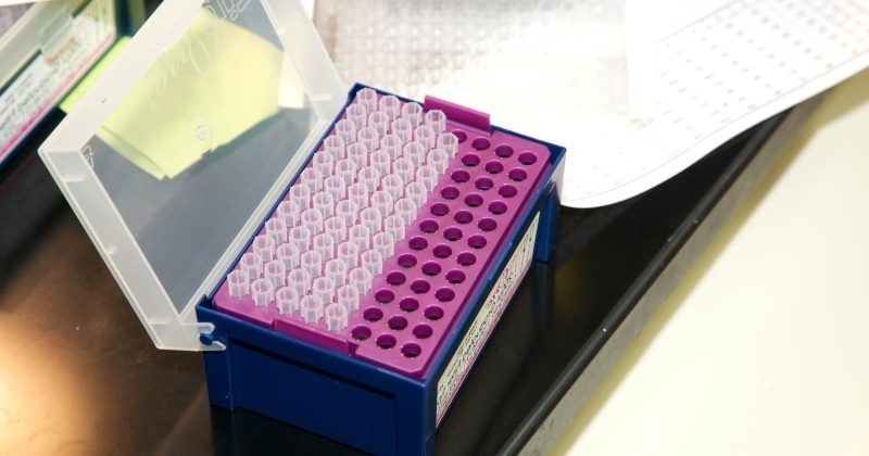 Nueva vacuna contra el VIH sera probada en Humanos